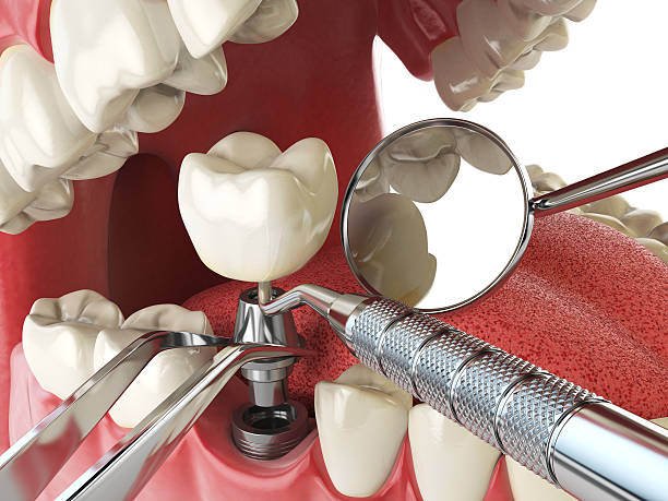 Best Emergency Denture Repair in Fairview, NJ
